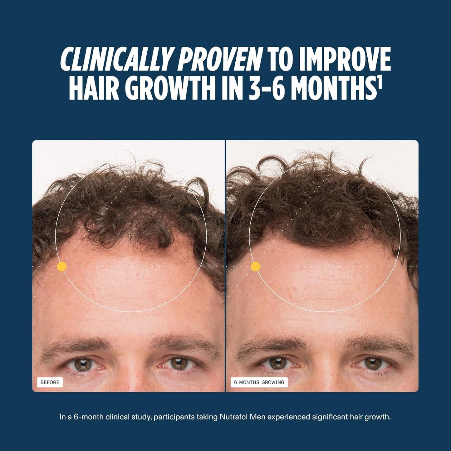 Nutrafol Men's Hair Growth Supplements, Clinically Tested for Visibly Thicker Hair and Scalp Coverage, Dermatologist Recommended - 3 Month Supply, Pack of 3