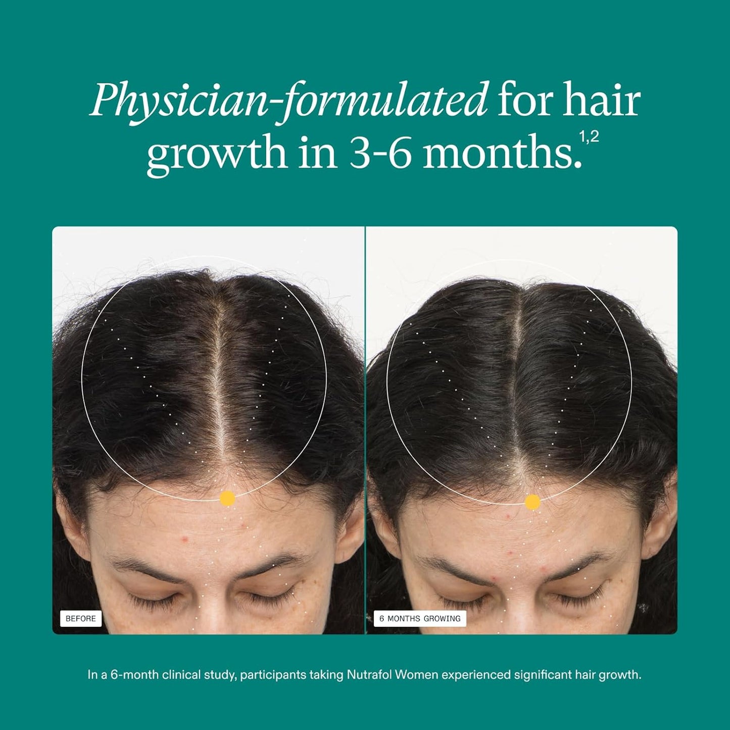 Nutrafol Women's Hair Growth Supplements, For Women 18-44 Years Old, Clinically Proven for Visibly Thicker and Stronger Hair, Dermatologist Recommended - 3 Month Supply, Pack of 3